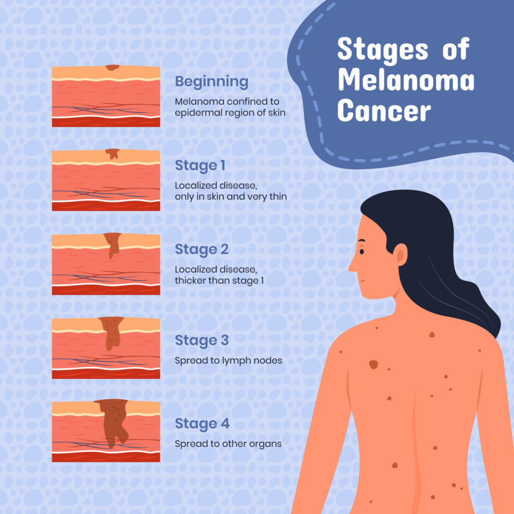  Understanding Skin Cancer: Types, Causes, Symptoms, and Treatment