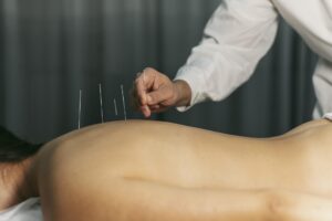 Arthritis and Acupuncture: Can It Help Relieve Pain?