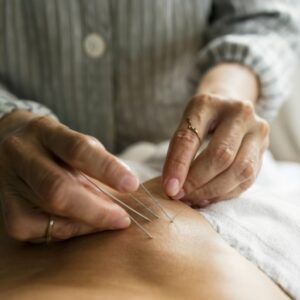 Arthritis and Acupuncture: Can It Help Relieve Pain?