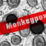 10 Key Facts About Mpox You Need to Know in 2024