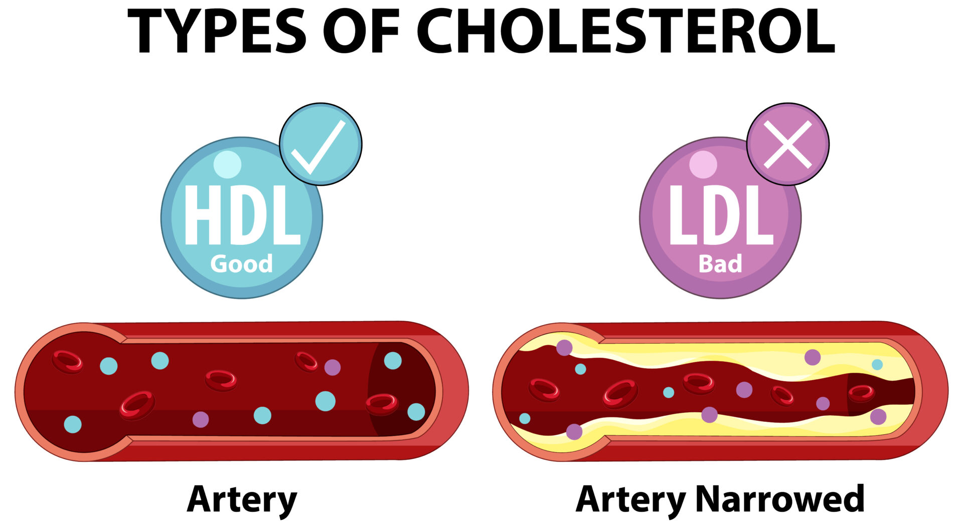 Everything You Need to Know About Cholesterol —Here’s the Truth!