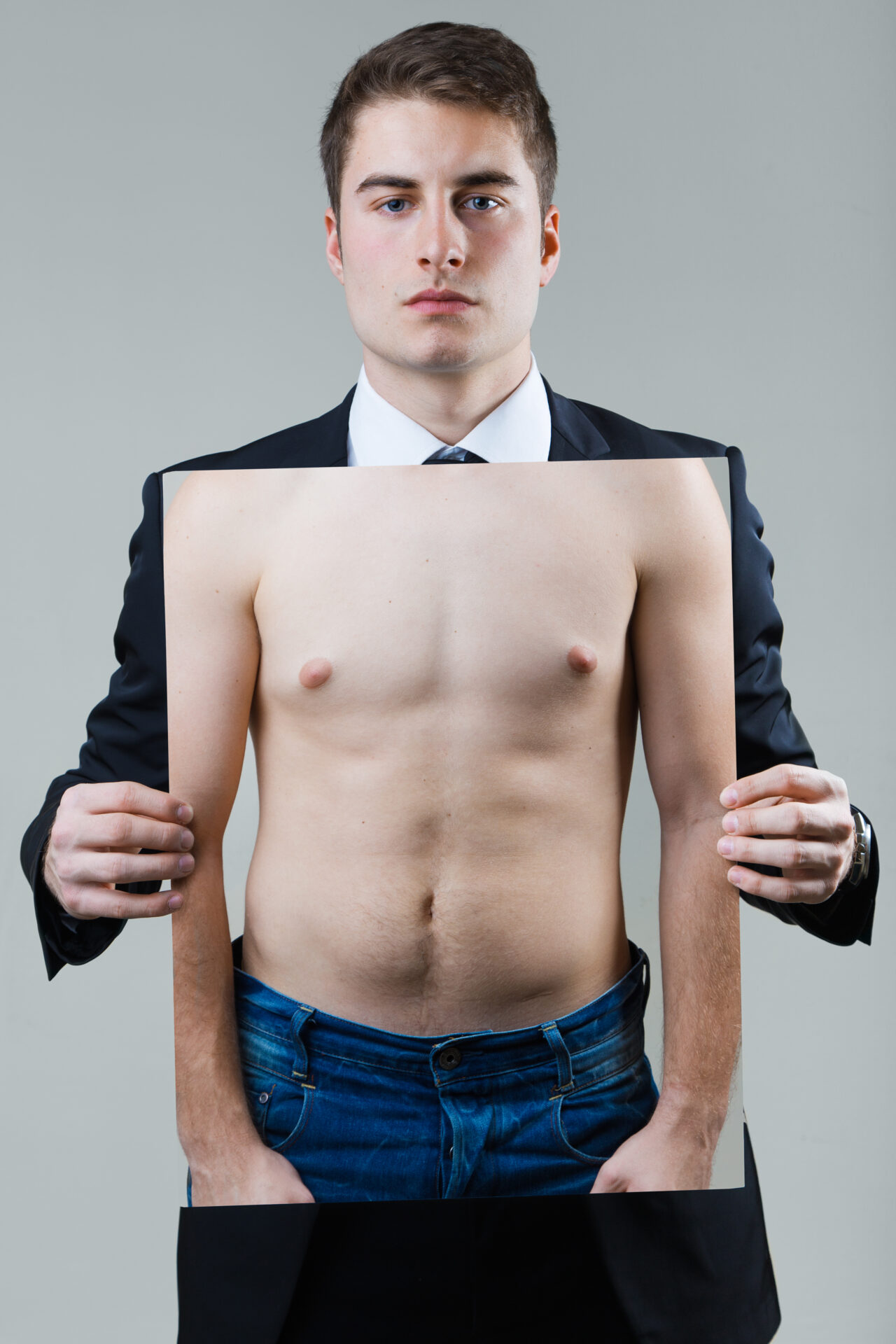 What is Gynecomastia? Causes and Treatment Options