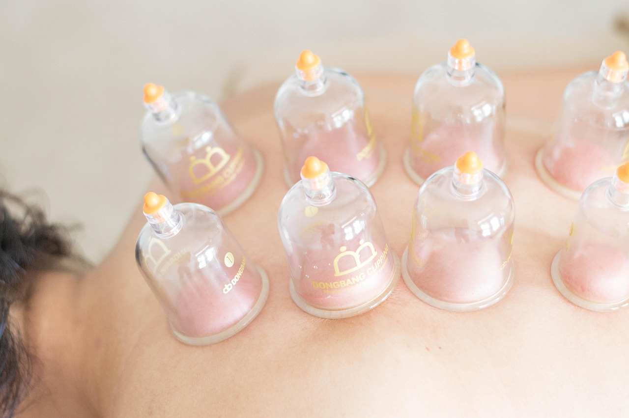 Cupping Therapy Removes Toxins – Does It Really Detoxify the Body?