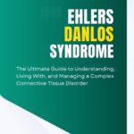 Ehlers-Danlos Syndrome (EDS): The Ultimate Guide to Understanding, Living With, and Managing a Complex Connective Tissue Disorder