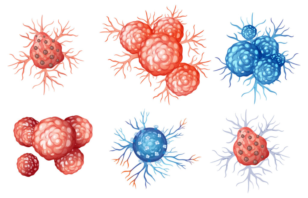 How the Brain-Eating Amoeba Attacks: A Scientific Explanation of PAM