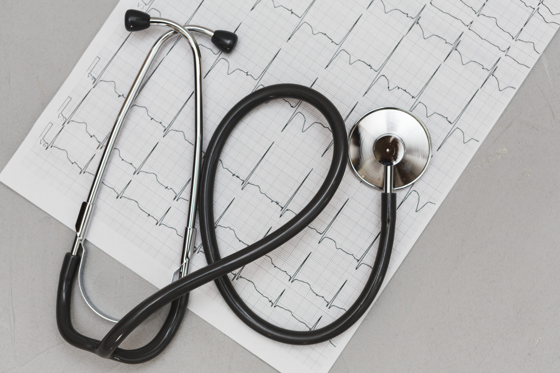 Atrial Fibrillation: What It Feels Like and When to Seek Help