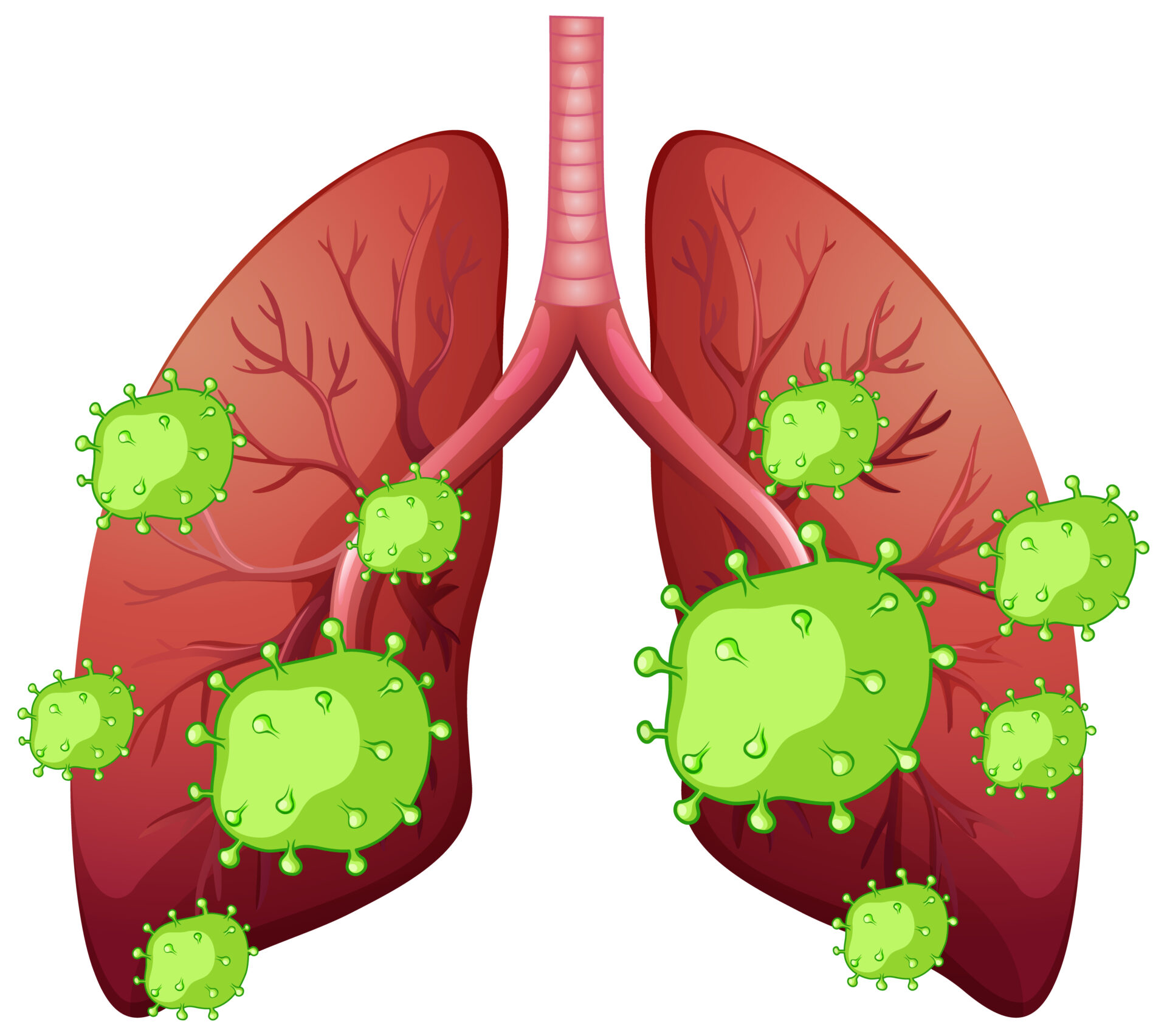 Is Pneumonia Contagious? Symptoms, Spread & When to Worry.