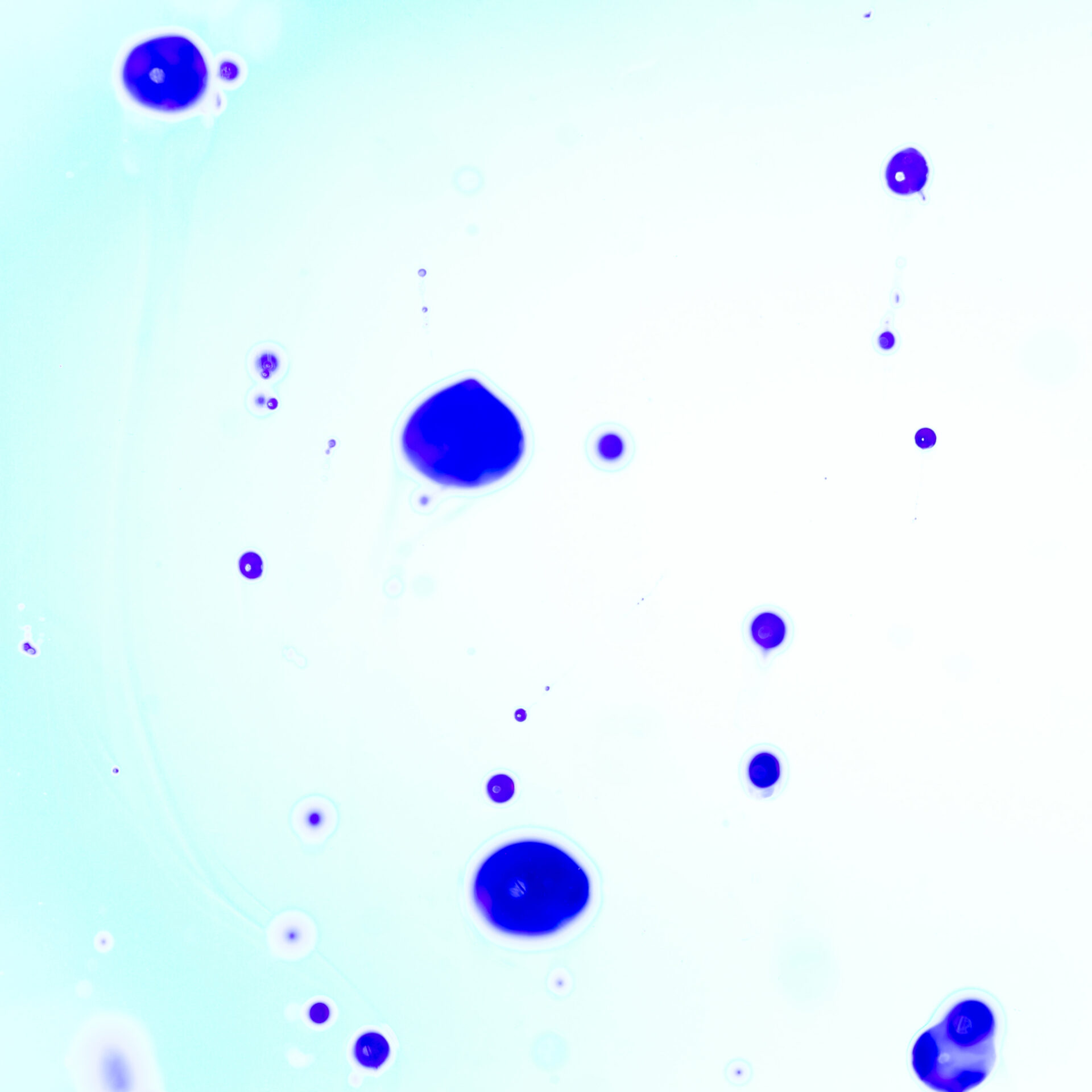 Can You Survive Brain Eating Amoeba? Explanation