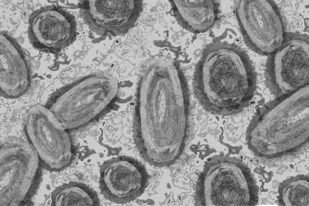 What Is Legionnaires' Disease? A Comprehensive Guide to Causes, Symptoms, and Diagnosis