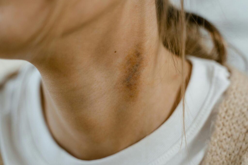How to Relieve Neck Pain Naturally at Home: Stretches, Heat Therapy & Posture Secrets